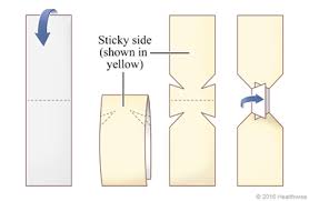 A diagram on how to make a butterfly bandage.